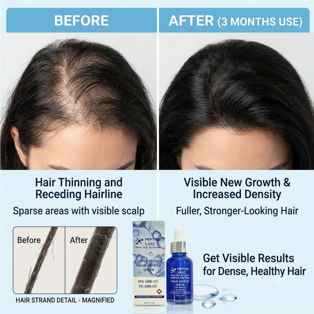 Эссенция для роста волос с пеп – обзор и цена Hair Care Elseve