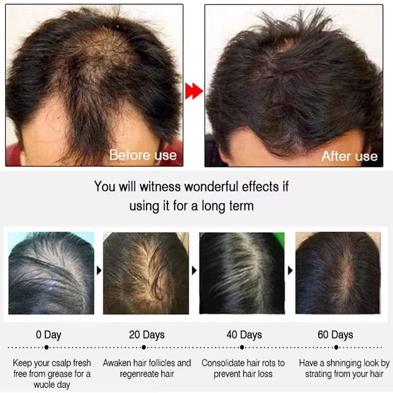 Спрей для быстрого роста волос – обзор и цена Hair Care Tonic